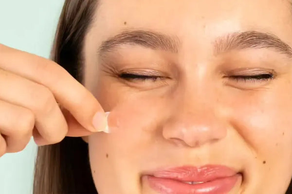 Targeted Acne Treatment With Pimple Patches