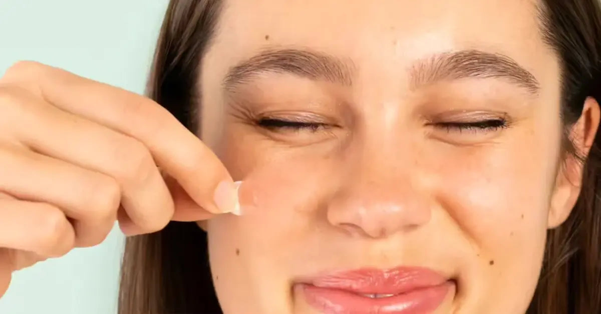 Targeted Acne Treatment With Pimple Patches