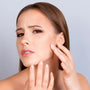 The Science Behind Hydrocolloid Pimple Patches