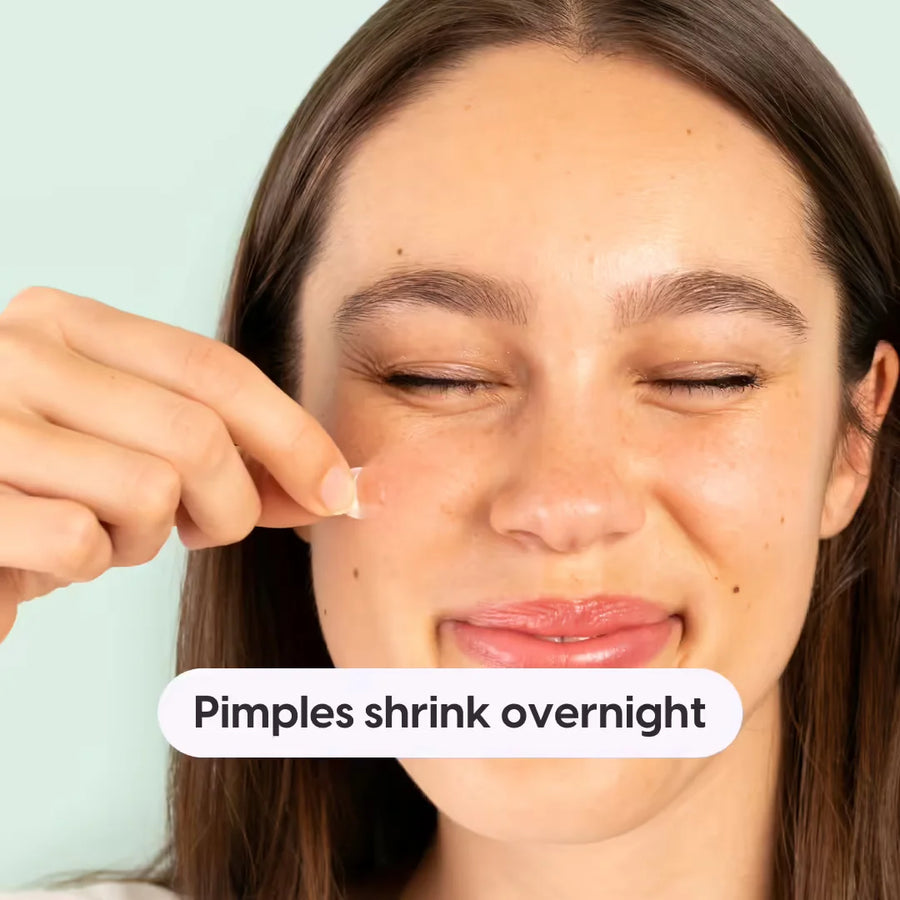 Best Pimple Patch The Patch Brand best-pimple-patch-the-patch-brand